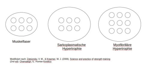 hypertrophie